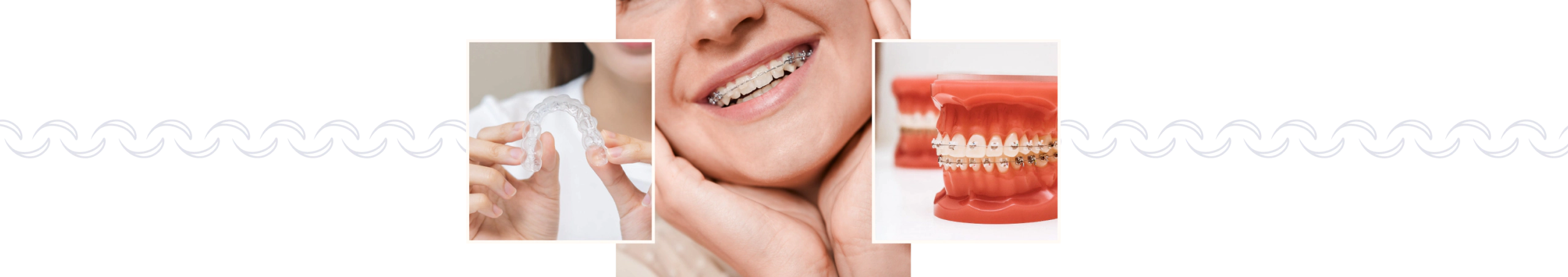 Mobile_Home_Orthodontic_Treatments Home Orthodontic treatments