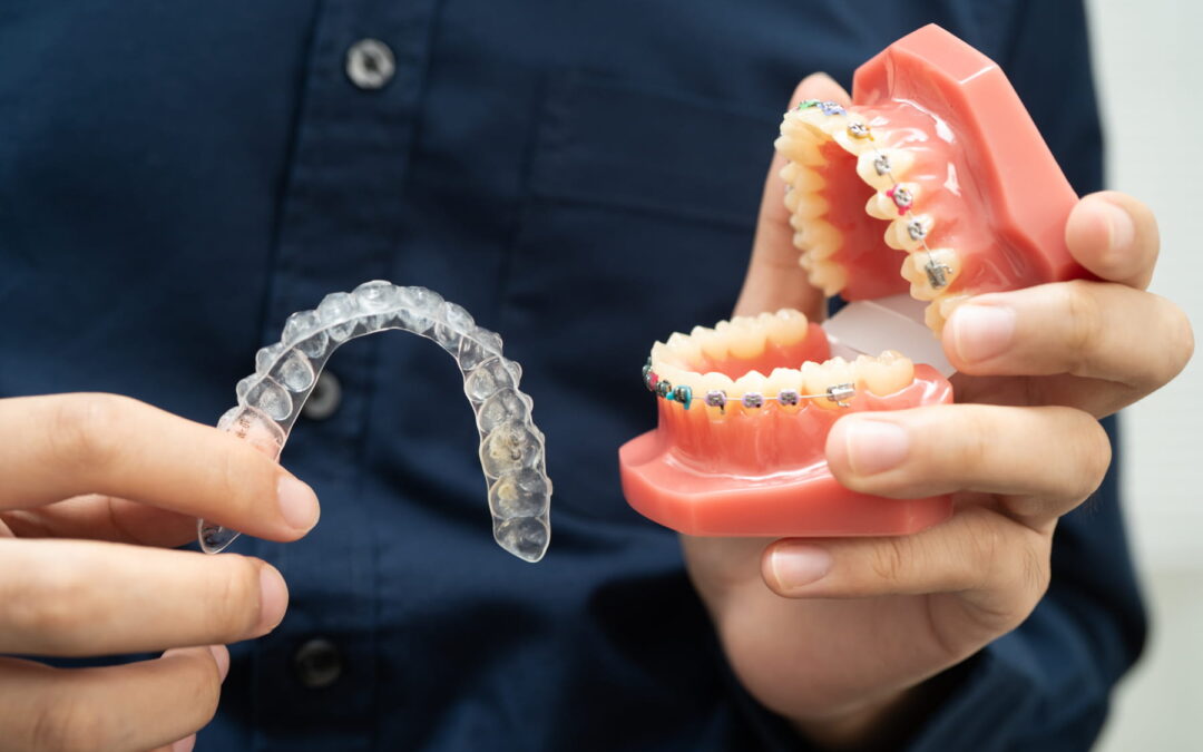Do I Need Braces or Invisalign in Mentor, Ohio? Signs It’s Time to Straighten Your Teeth