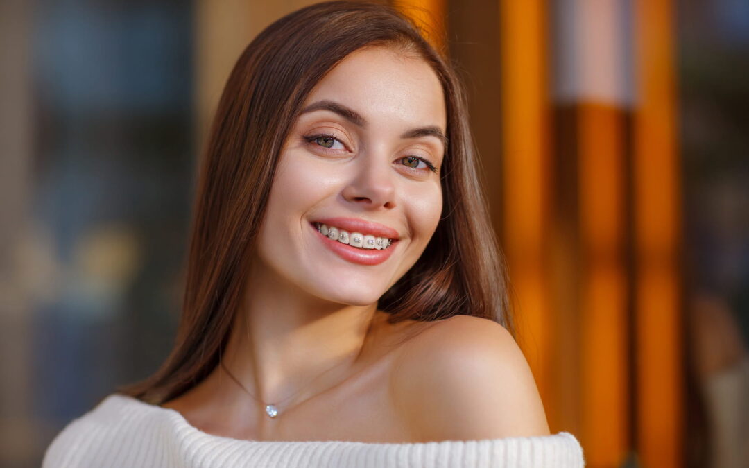 Overbite, Underbite, Crossbite, and Crowding Explained: Which One Do You Have?